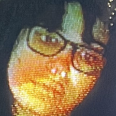 Mox