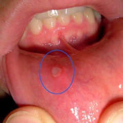 dr