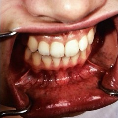 pr4sm
