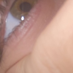 DU
