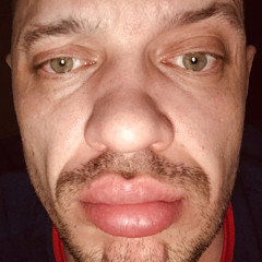 Blinyo