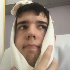 FAN2glennkqkqFAN