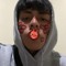 Diexo