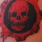 gangrena