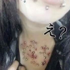 traumatized