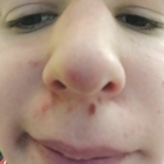 Richo