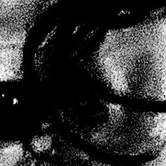 Louis Patison | ANLM