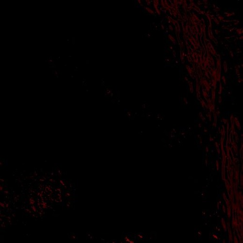 Extrenor - The Tower Experiment [rmx | free dl]