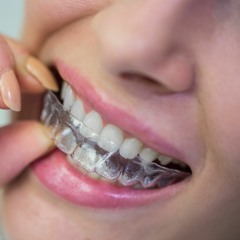 Best Invisalign Dental Clinic in Beverly Hills