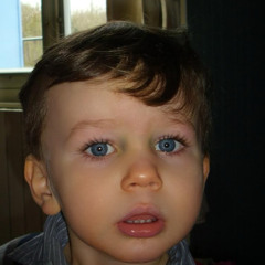 zolkid