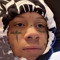 veryrarekid
