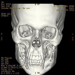 thyroidmix