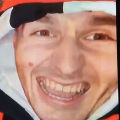 Baumi auf crack