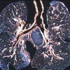 black Bong Lungs