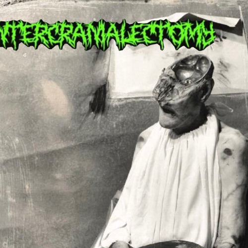 INTERCRANIALECTOMY’s avatar