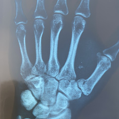 XA3