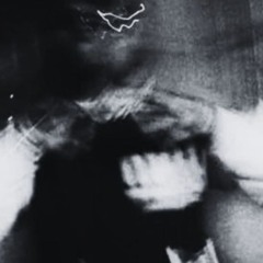 Æ-KILL3ER