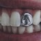 angerinmyskin