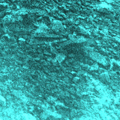 Roentgen