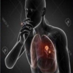 Kill Myself In The Castle