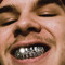 187LUCID