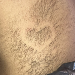 scorta