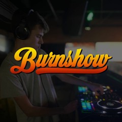Burnshow