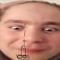 Bliz