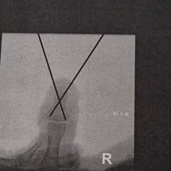 Multi[PER]PlexX