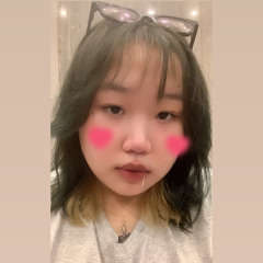 Béo_2411