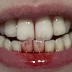 teen83a18