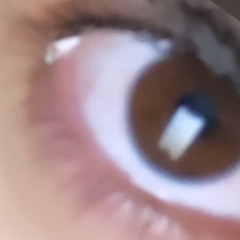 FHAD
