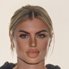 $