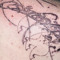 Spleen