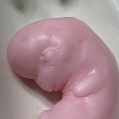 fetus