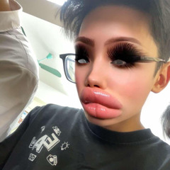 trungkien