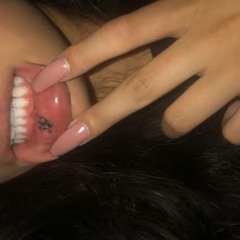 KD