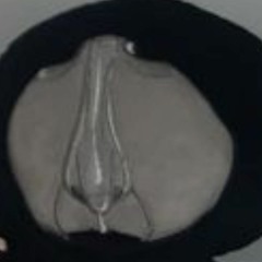 horhorhorhorhor
