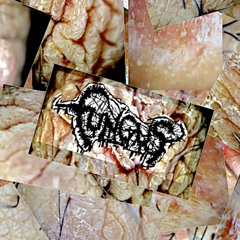 Dermatophytosis