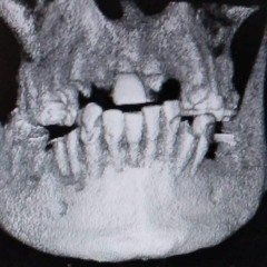 Spookidy Killingsworth