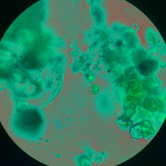 come acido miguelito