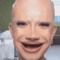 umm irdk