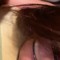 follicle