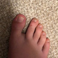 toe gap