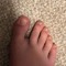 toe gap