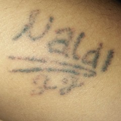 Naldi