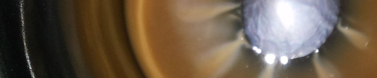 SoundCloud banner for @wound