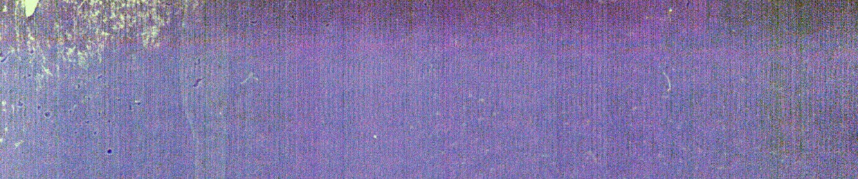 _rh