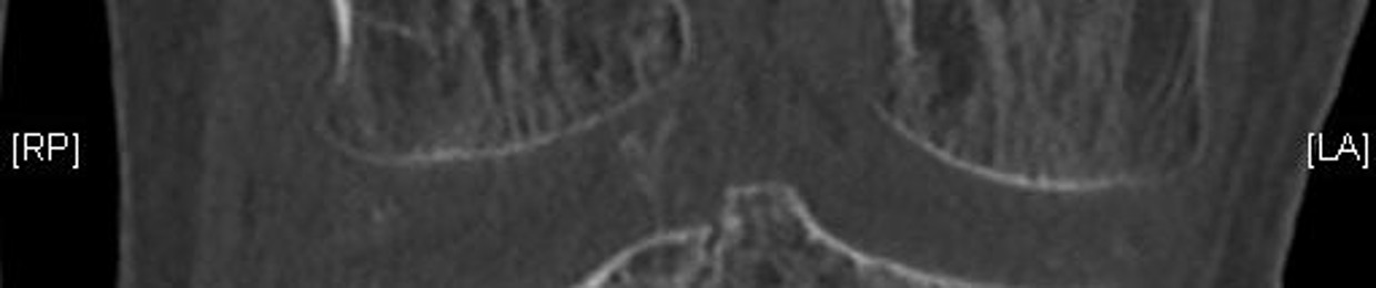 misstransilvanic
