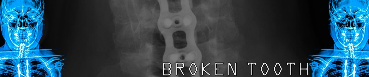 Broken Tooth